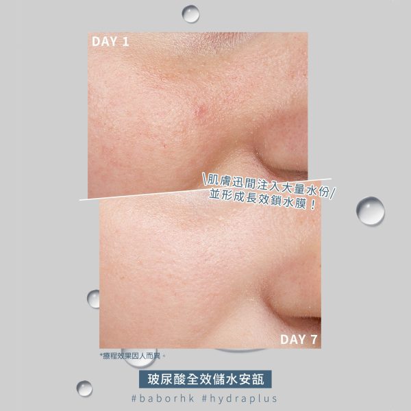 德國 [BABOR] 透明質酸儲水安瓿 Hydra Plus