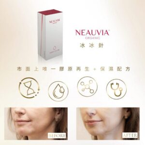 [Neauvia] Organic Hydro Deluxe 女神冰冰針
