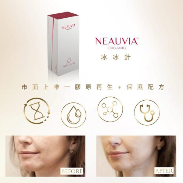 [Neauvia] Organic Hydro Deluxe 女神冰冰針